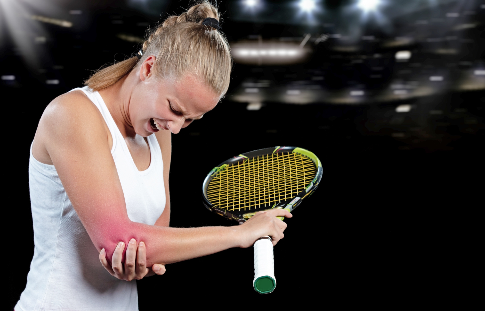 How Can Dry Needling Help My Tennis Elbow?